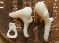 Bone 2, set of ossicles.